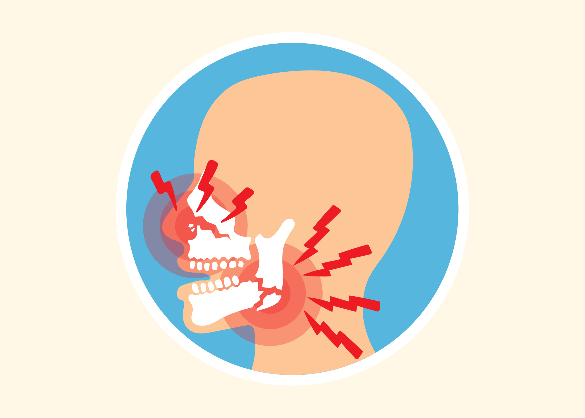 Icon of a human skull highlighting jaw pain and bone fractures.